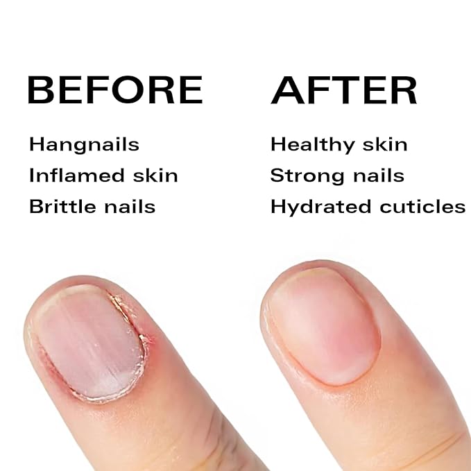 Beauty Power Nail Oil Cuticle Pen - Rose – Nail Strengthener & Growth Serum with Vitamin A, D, E, B5, Grapeseed & Natural Oils – Repair for Brittle, Peeling, Thin Nails – Gift Idea