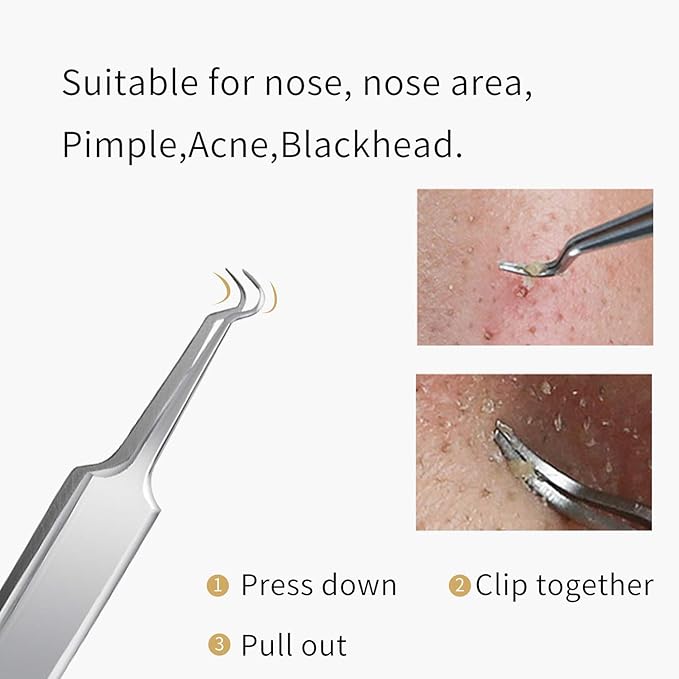 FIXBODY Blackhead and Splinter Remover Tools - Stainless Steel Professional Easily Cure Pimples Whiteheads Comedones Acne Zit Ingrown Hairs and Facial Impurities Bend Head Tweezer Surgical Kit