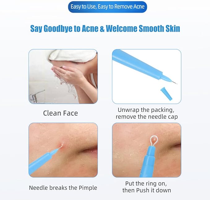 2 Pack of Disposable Sterile Acne Remover Tools Safe Pimple Popper Tool Aseptic Blackhead Remover Tools Sanitary Comedone Extractor Tool Pimple Extractor Tool