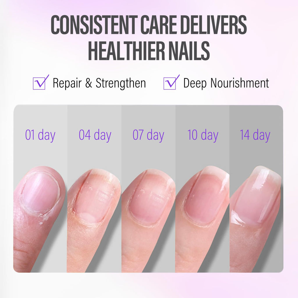 CHUCHU Nail Cuticle Oil Strengthener - Lavender Nail Repair Growth Moisturizing Treatment - Natural Jojoba Vitamin B & E for Dry Cracked Nails
