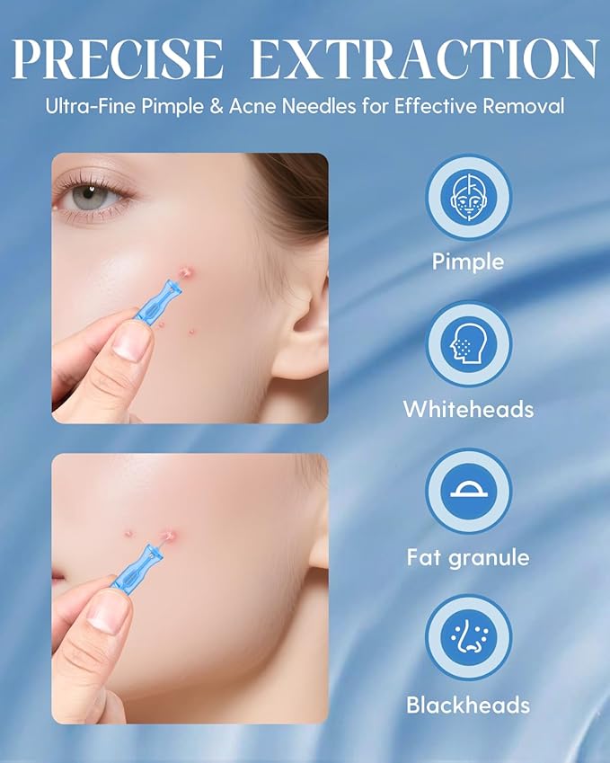 DTTIYXI Pimple Needle 50PCS, Sterile Acne Needle Kit & Pimple Popper Needles for Blemish & Blackhead Removal, Disposable Extraction Tools for Clear Skin (Home & Salon Use)