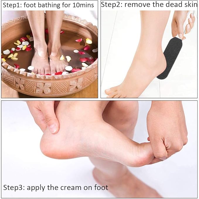 Professional Pedicure Foot File - Reusable Stainless Steel Cracked Skin Corns Callus Remover Feet Rasp