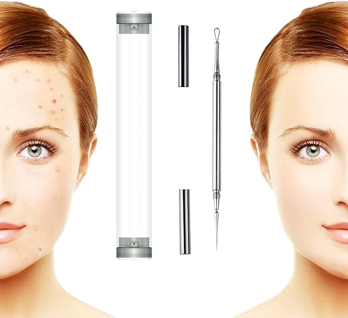 Professional Facial Milia Removal and Whitehead Extractor & Lancet - Double Ended Circle Loop & Sharp Needle Pimple Popper Tool - 2-in-1 Blackhead & Blemish Remover - Zit and Pimple Acne Removal