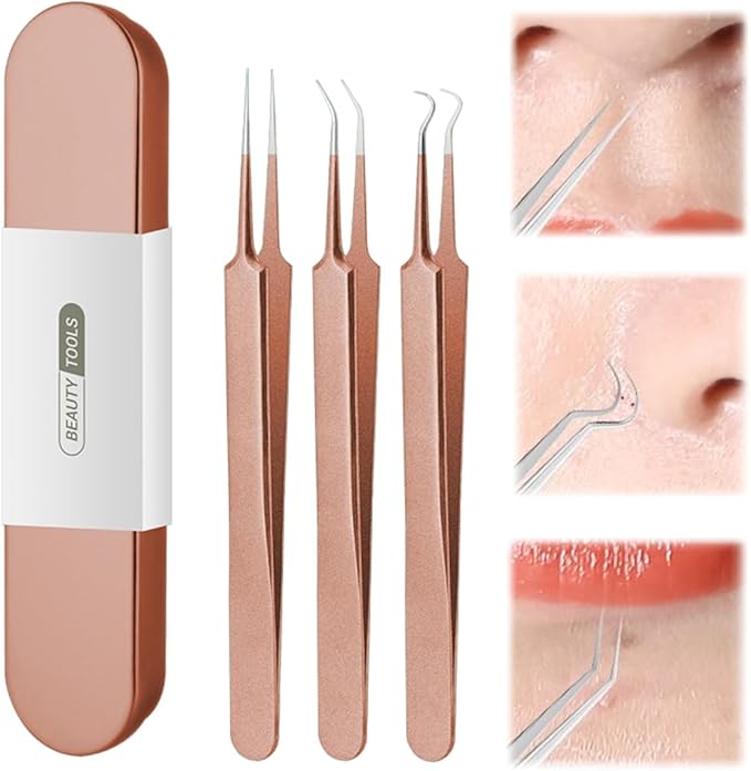 Usiveinborn Blackhead Remover Upgraded, Usiveinborn Blackhead Tweezers, Professional Upgraded Facial Blackhead Remover Tweezers, Blackhead Remover Tools Sets (A5-Rose-Gold-3pcs)