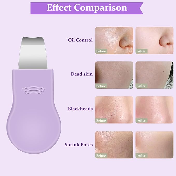 Blackhead Remover Tool,Silicone Face Scrubber, 2 in 1 Nose Pore Scraper for Deep Cleansing,Face Skin Spatula, Nose Black Head Remover, Pore Cleaner Skin Care Tool for Men Women Gifts