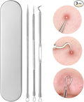 3 Pcs Blackhead Remover Comedone Extractor, Acne Removal Kit, Manual Pimple Popper Tool for Quick and Easy Removal of Pimples, Blackheads on Forehead, Facial and Nose (Needle 3 Pack)