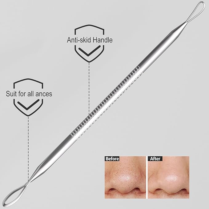 Cbiumpro 6 Pack Blackhead Remover Tools, Pimple Popper Tool Kit, Professional Blackhead Extractor for Zit, Acne, Whitehead, Comedone on Nose - with Case