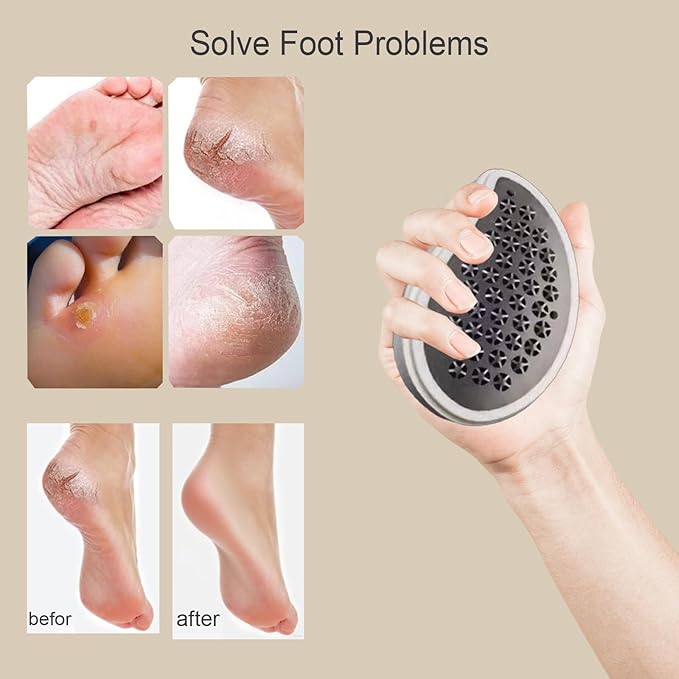 Professional Crystal Hair Remover - Nano Glass Epilator & Exfoliator 2-in-1 Glass Nano-Crystallization Hair Eraser (Prevents Razor Bumps) + Foot Exfoliator with Debris Cup, Reusable Unisex Gift