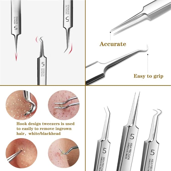 Professional Facial Blackhead Remover Tweezers,3Pcs Precision Pimple Popper Tool Kit for Whitehead Ance Blemishs Comedones Stainless Steel Makeup Tool - Glossy