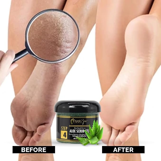 FOOT SPA Callus Remover Exfoliating Scrub Gel – Pumice & Salicylic Acid Dual-Action Formula for Feet, Hands, Elbows & Knees | Sulfate-Free, Cruelty-Free | Salon & At-Home Use | 4 oz