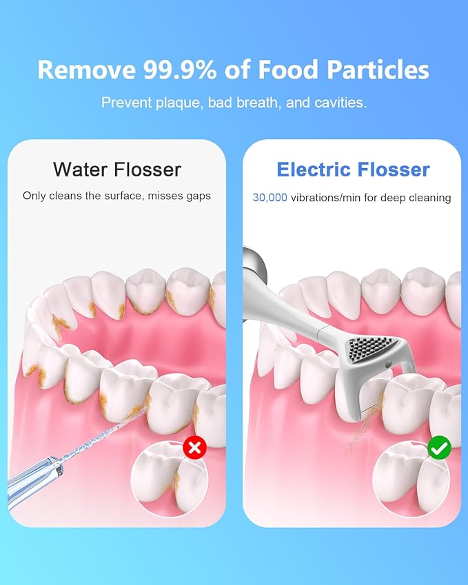 Rechargeable Electric Flosser–4-Speed Dental Flosser with 60 Heads & Tongue Cleaner – contactless Charging Base for Adults & Kids – Dentist-Approved Gum Care & Water Flosser Alternative