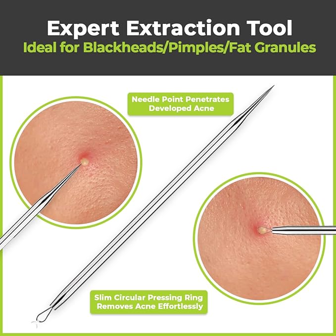 2 Pcs Pimple Extractor Tool 410 Grade Stainless Steel | Comedone Extractor, Pimple Popper, Blackhead Remover for Face, Zit Popper, Pimple Needle for Acne Removal