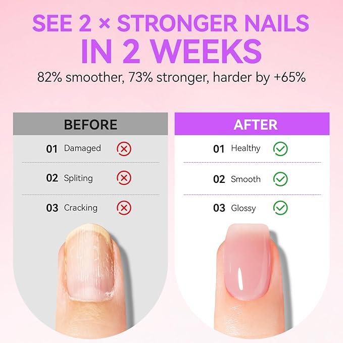 Natural Nail Growth & Oil Kit: Rose & Pomegranate Nail Care Set - Deep Repair for Damaged Nails - Rich Winter Scent - Cruelty-Free Vegan Formula