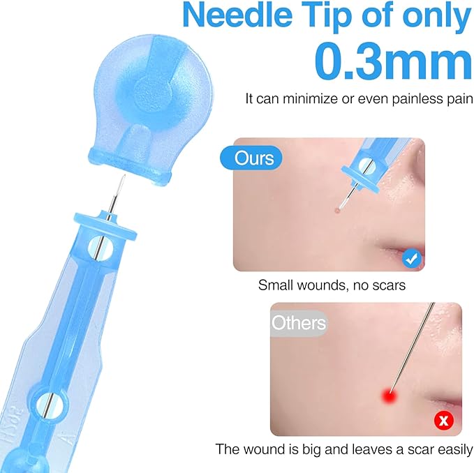 MixS Live Sterile Pimple Needle Kit - 80 pcs 0.3mm Ultra-Fine Acne Needles + 108 Dots Acne Pimple Stickers - Effective Blemish & Blackhead Removal Tools for Clear Skin