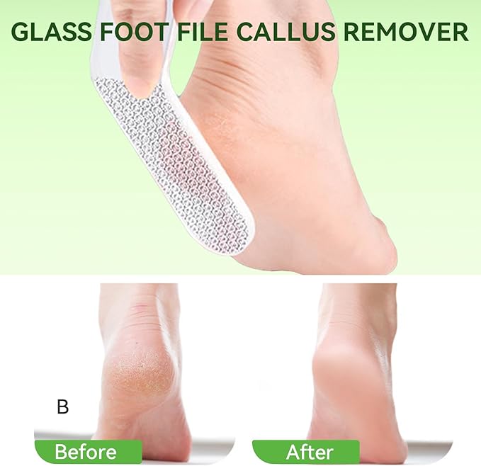 ESUOHYM Glass Foot File Triangle Shaped Callus Remover Feet Heel Scrubber Dead Skin Scraper Pumice Stone Professional Pedicure Tools for Women and Men