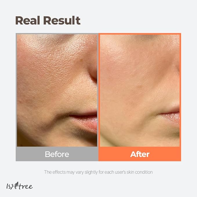 ISNTREE Green Tea Fresh Toner | Korean Toner with Green Tea | Hydrating Facial Toner for Oily Skin, Sebum Control & Refreshing Care, 6.76 fl oz