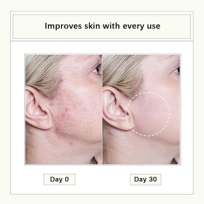 CISTTO Natural Cleansing Oil – mini portable makeup remover oil, Nourishing and Gentle for Sensitive Skin and All Skin Types, Travel-Friendly, 2ml x 20 Capsules