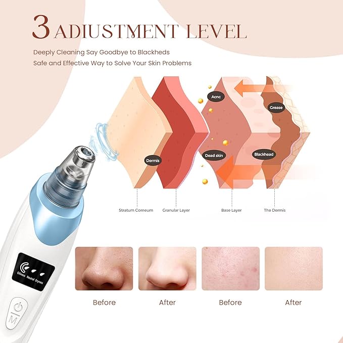 2026 Blackhead Remover Pore Vacuum,Facial Pore Cleaner-5 Suction Power,5 Probes,USB Rechargeable Blackhead Vacuum Kit Electric Pore Vacuum Tool for Adult