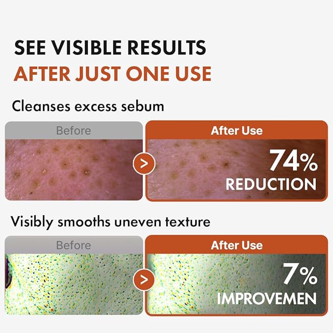 Hanskin BHA Pore Cleansing Oil - Korean Deep Pore Cleansing Makeup & Sebum Remover XL for Oily & Combination Skin, Lightweight Double Cleansing Oil, 10.14 oz