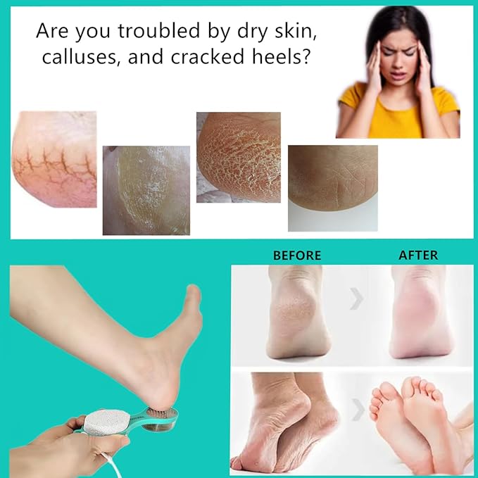 YIOYOODA Foot File Callus Remover 5-in-1, 2 Pcs Feet Scraper Pedicure Tools with Pumice Stone, Scrubber Brush, Stainless Steel Foot Rasp and Sand Paper Debris Catcher, Multi Purpose, Cyan