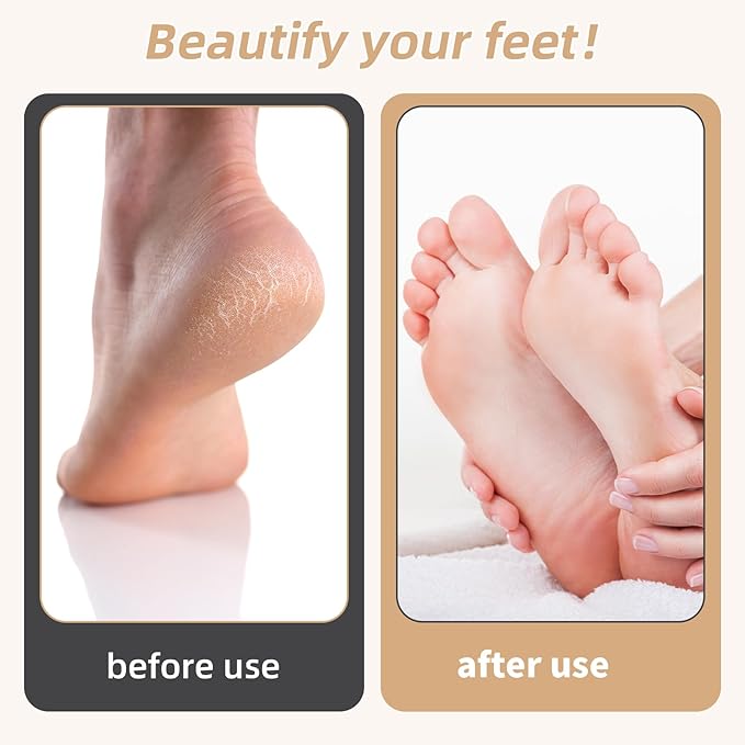 Foot Callus Remover, Foot File Callus Remover for Feet, Double Sided Foot Scrubber with Soft Silicone Brush, Pedicure Tools for Feet Care Dead Skin Calluses