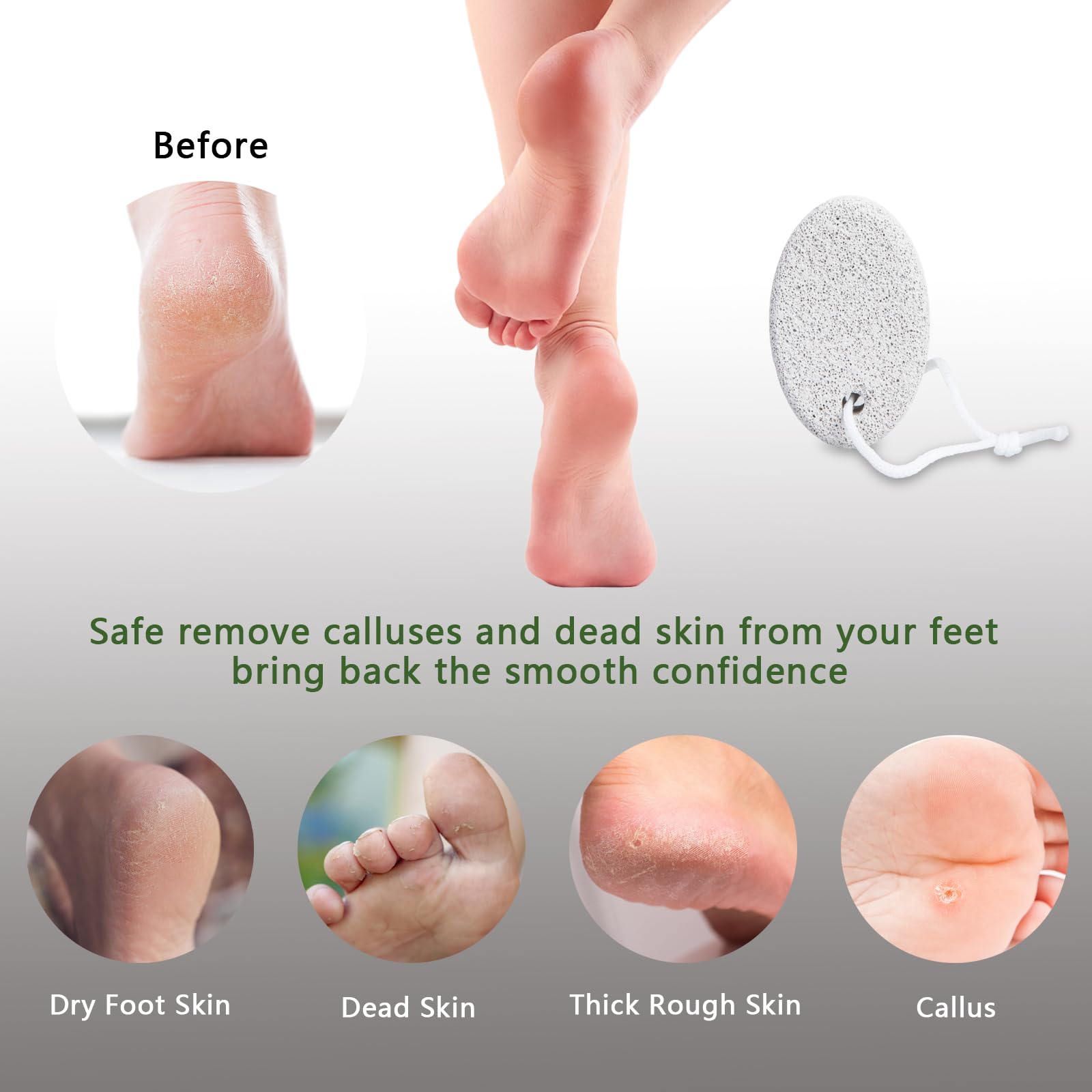 Natural Foot Pumice Stone for Feet, Borogo 2-Pack Lava Pedicure Tools Hard Skin Callus Remover for Feet and Hands - White