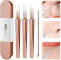 Usiveinborn Blackhead Remover Upgraded, Usiveinborn Blackhead Tweezers, Professional Upgraded Facial Blackhead Remover Tweezers, Blackhead Remover Tools Sets (A5-Rose-Gold-4pcs)