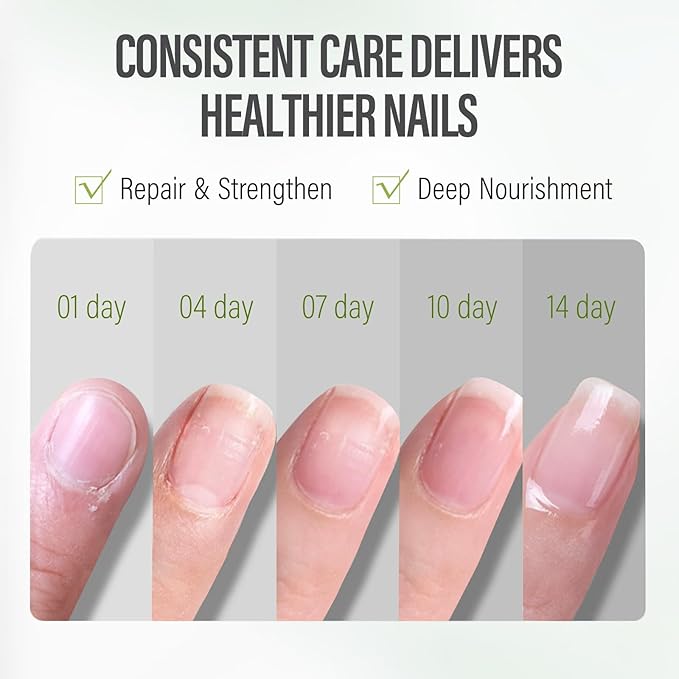 CHUCHU Vegan Cuticle Oil for Nails: Aloe Vera Jojoba Nail Cuticle Oil with Vitamin B & E for Moisturizes Cuticle and Nail's Skin - Prevents Hangnails and Chapped 15ML