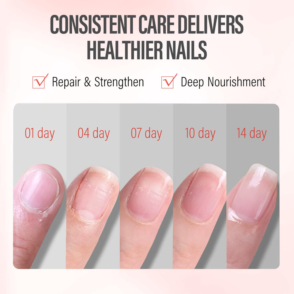 CHUCHU Vegan Cuticle Oil for Nails: Pomegranate Jojoba Nail Cuticle Oil with Vitamin B & E for Moisturizes Cuticle and Nail's Skin - Prevents Hangnails and Chapped 15ML