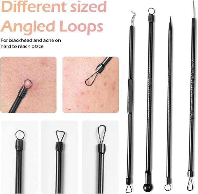 Blackhead Remover Pimple Popper Tool Kit for Nose Face Skin Blemish Extractor Tool(6 Piece Kit),Black