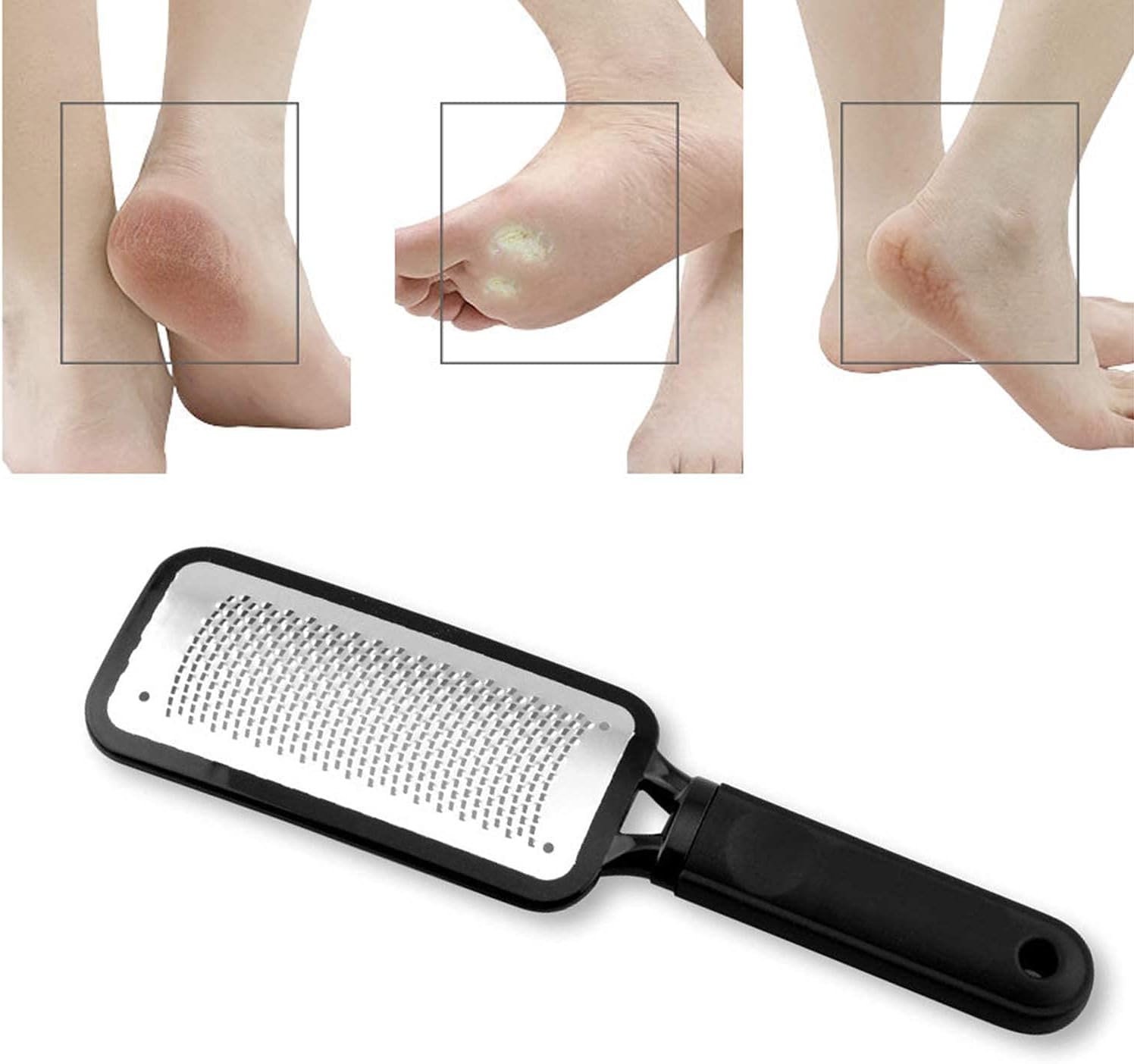 Professional Foot Files Callus Remover, Black, 1 Pack