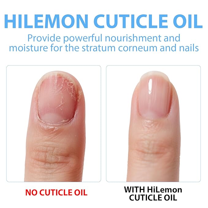 HiLemon Natural Cuticle Oil for Nails Essential Oil Revitalizing Overnight Hydration for Dry Cuticles with Vitamin E Repaired Softener Nail Strengthener Protector for Damaged Skin