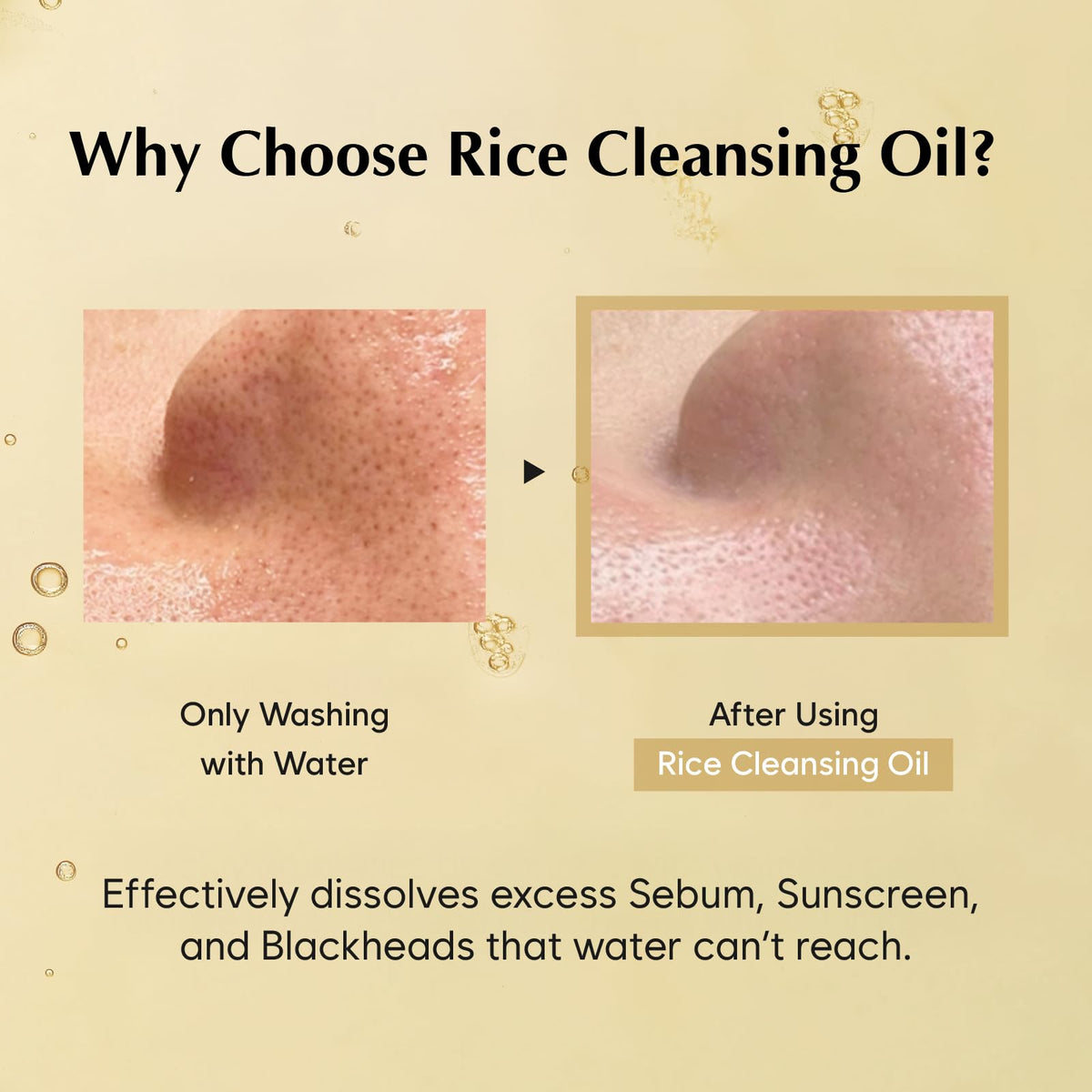 MIDHA Rice Bran Cleansing Oil, Gentle Makeup Remover for Face, Deep Pore Cleanser, Sebum Control, Hydrating Facial Cleanser, Safe for All Skin Types, Korean Skin Care, 6.76 fl. Oz