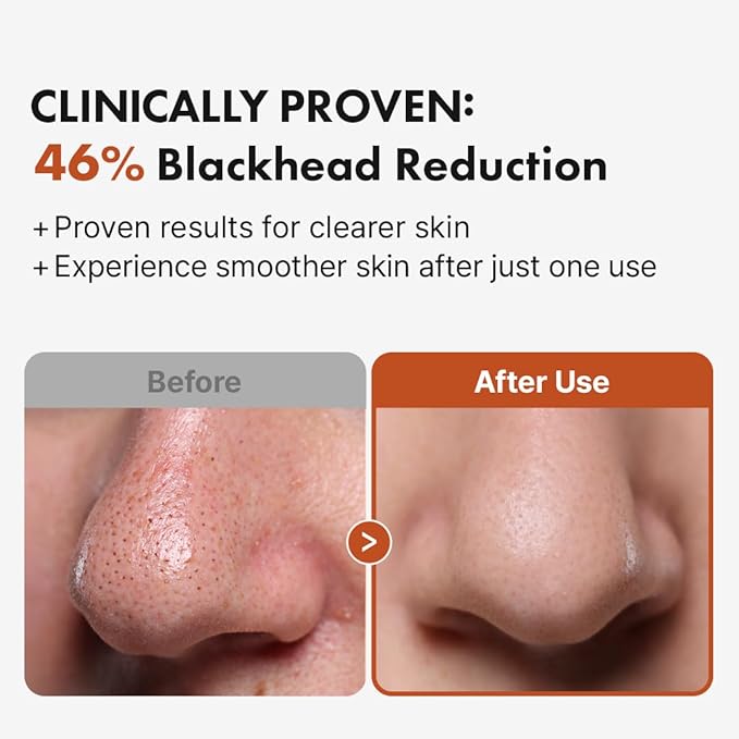 Hanskin BHA Pore Cleansing Oil - Korean Deep Pore Cleansing Makeup & Sebum Remover XL for Oily & Combination Skin, Lightweight Double Cleansing Oil, 10.14 oz