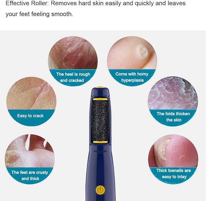 Replacement Roller Compatible with Dr. Scholl's Callus Remover Electronic Foot File-Extra Coarse (12 Pack)