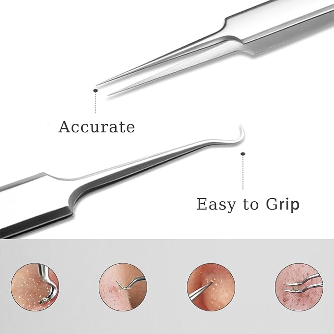 5pcs Blackhead Remover Tweezers Pimple Popper Tool Kit, Precision Acne Needle Comedone Blackhead Tweezers Extractor Removal Whitehead Popping Zit for Nose Face Skin Blemish Extractor Tool - Glossy