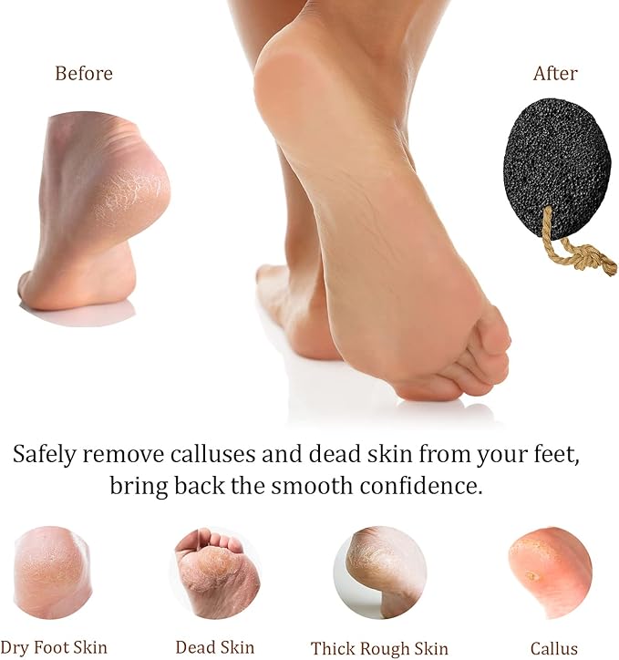 Pumice Stones for Feet - Natural Earth Lava Black Pack of 2 - Callus/Corn Remover for Feet Heels and Palm - Pedicure Exfoliation Tool - Dry Dead Skin Scrubber - Health Foot Care