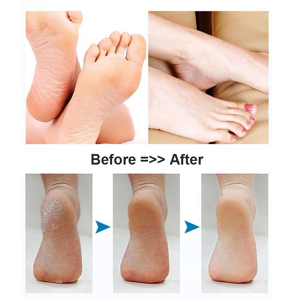 BOMPOW Foot Scrubber Electric Callus Remover Rechargeable Foot File Hard Skin Remover Pedicure Tools Electronic Callus kit for Cracked Heels and Dead Skin with 2 Roller Heads, Blue