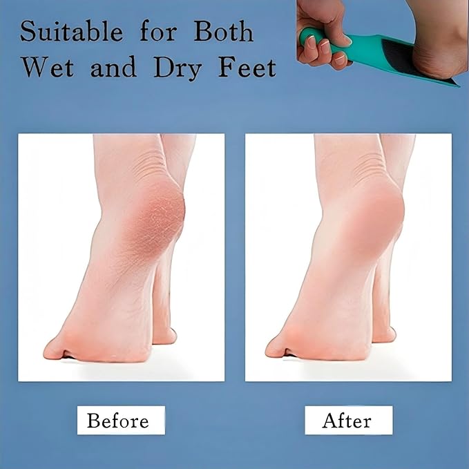 KINTEGOOD U-Shaped Curved Foot File, Double-Sided Dead Skin Callus Remover, Foot Scrubber for Wet and Dry Feet – Curved Design for Full Heel & Side Exfoliation‌, 1 PCS Light Green