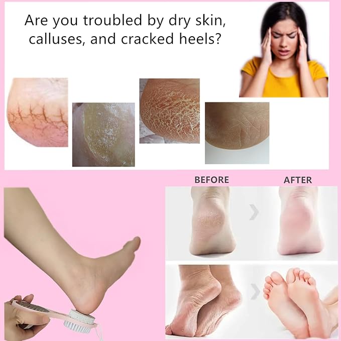 YIOYOODA Foot File Callus Remover 5-in-1, 2 Pcs Feet Scraper Pedicure Tools with Pumice Stone, Scrubber Brush, Stainless Steel Foot Rasp and Sand Paper Debris Catcher, Multi Purpose, Pink