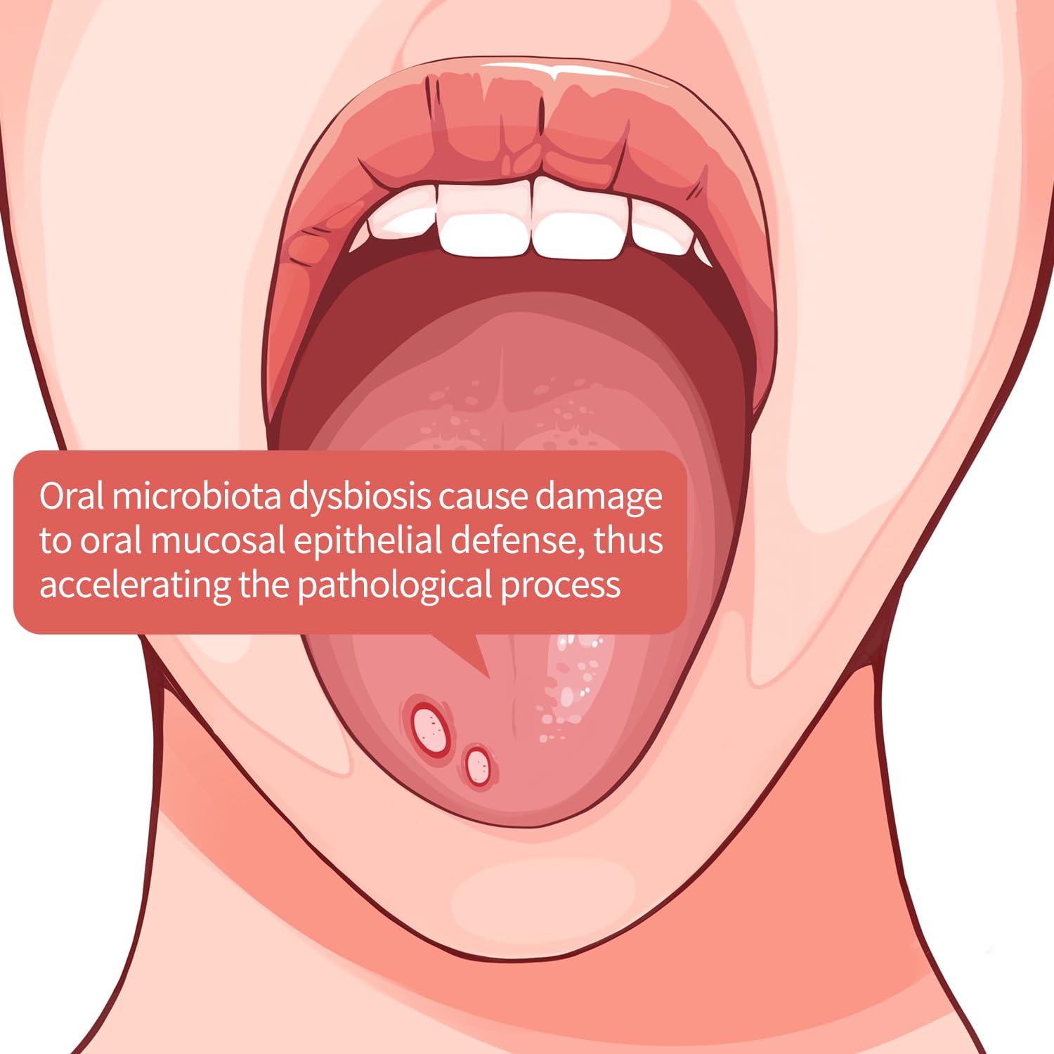 Tongueclear Oral Mucosal Cleaner|Silicon Oral Care Cleaner|Gum Massager with Air Bag(1 pc)