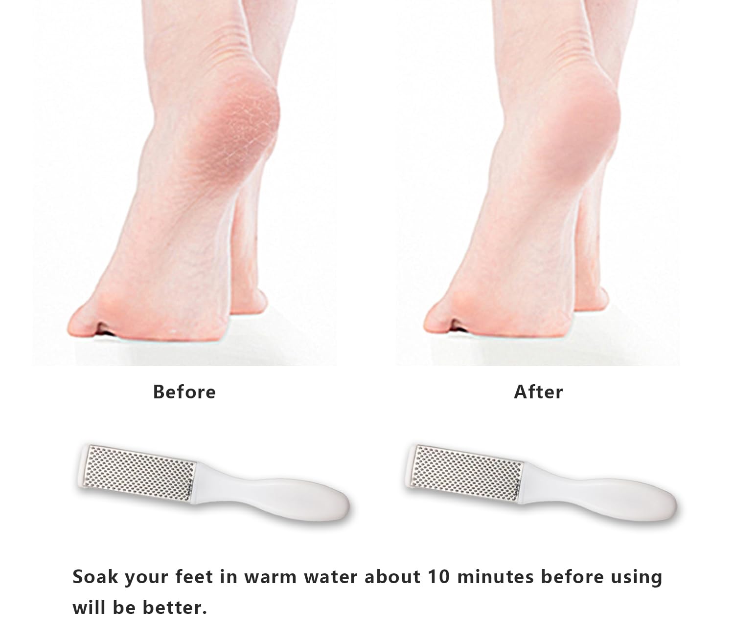 Professional Foot Files Callus Remover,Foot Scrubber for Dead Skin,Stainless Steel Foot Rasp-White(1 Pack)