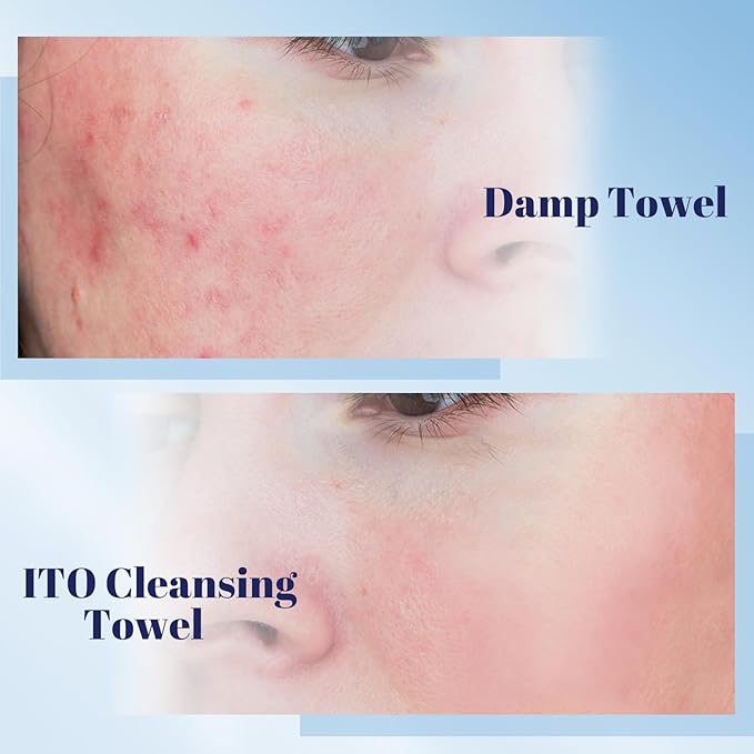 ITO Face Towels, Ultra-Soft & Extra Thick Cleansing Towels for Sensitive, Dry & Oily Skin, Facial Tissue, Makeup Remover Disposable Towels (70 Count (Pack of 3))