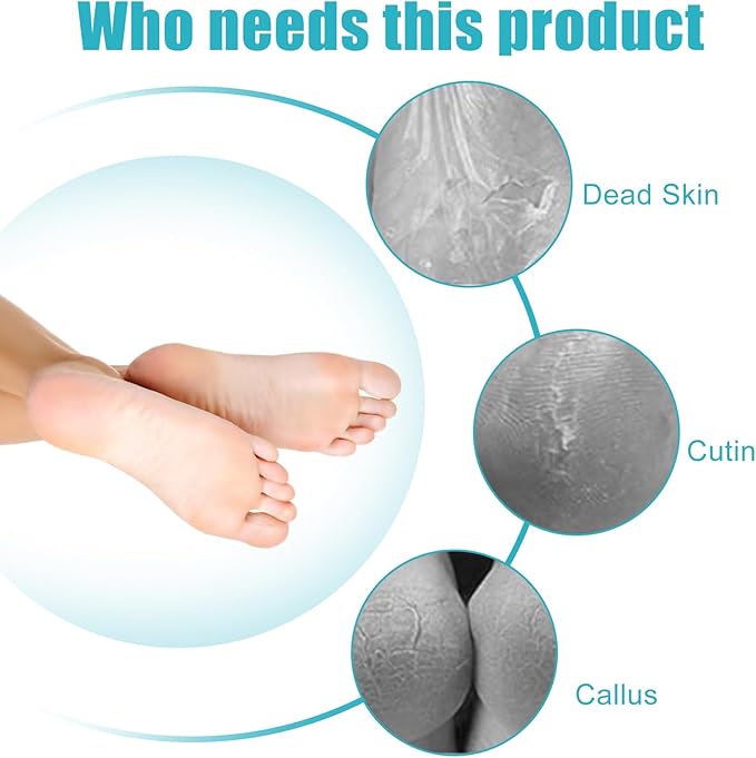 Foot File Callus Remover-3 Pcs 4 in 1 Foot Scrubber Dead Skin Remover for Feet,Pumice Stone, Foot Rasp and Sand Paper for Home Foot Care,Foot Brush for Shower (Grey Pedicure Foot File)