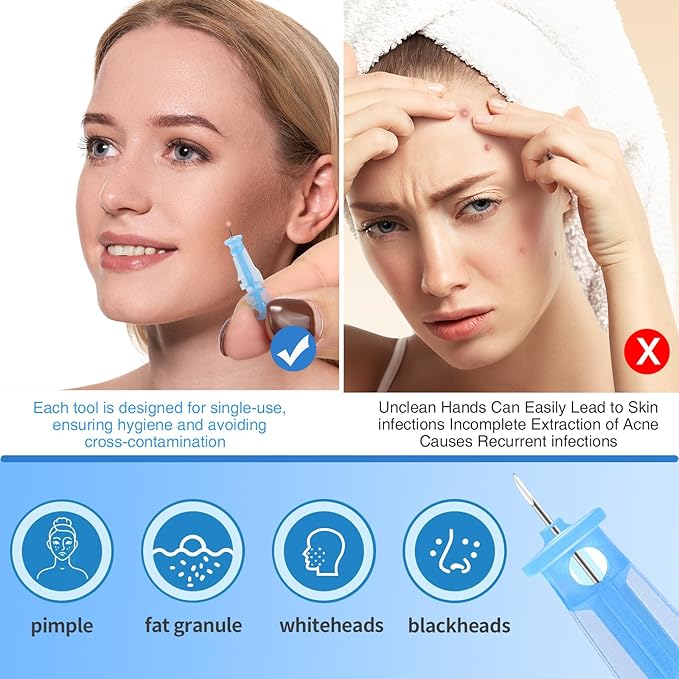 MixS Live Sterile Pimple Needle Kit - 80 pcs 0.3mm Ultra-Fine Acne Needles + 108 Dots Acne Pimple Stickers - Effective Blemish & Blackhead Removal Tools for Clear Skin