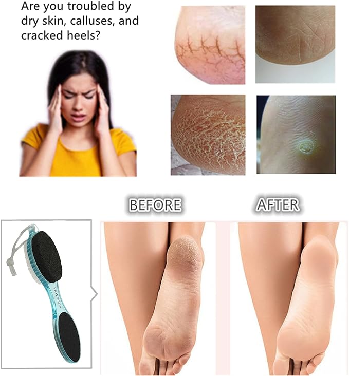 Foot File Callus Remover 4-in-1, Feet Scraper Pedicure Tools with Pumice Stone, Scrubber Brush, Foot Rasp and Sand Paper, Double Sided Multi Purpose, Clear Black and Blue