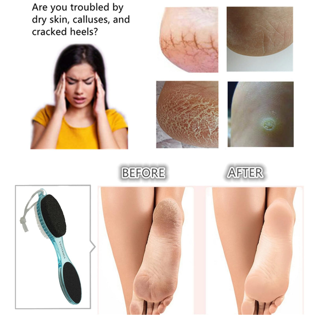 YIOYOODA Foot File Callus Remover 4-in-1, Feet Scraper Pedicure Tools with Pumice Stone, Scrubber Brush, Foot Rasp and Sand Paper, Double Sided Multi Purpose, Clear Pink and Blue