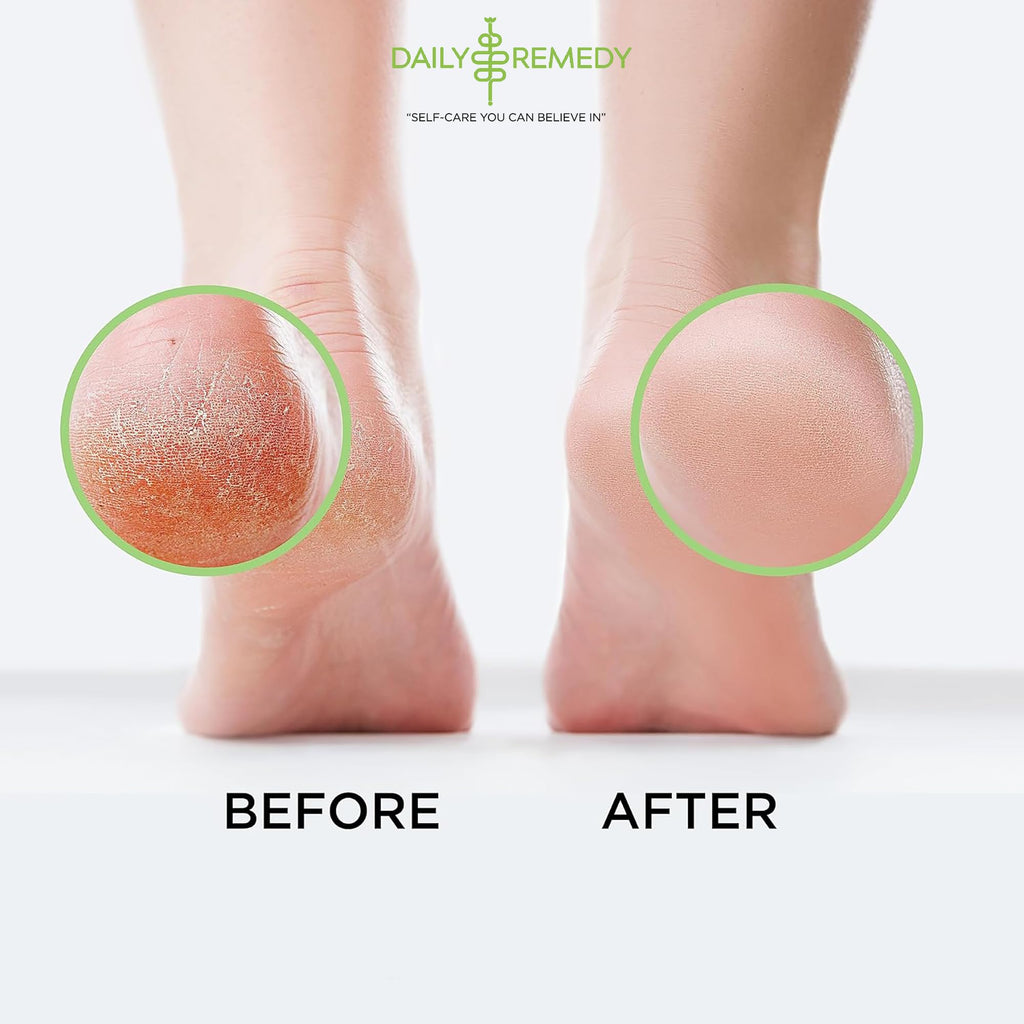 Tea Tree Oil Foot Soak with Epsom Salt - Made in USA - for Toenail irritations, Athletes Foot, Stubborn Foot Odor Scent, Softens Calluses & Soothes Sore Tired Feet - 16 Ounce