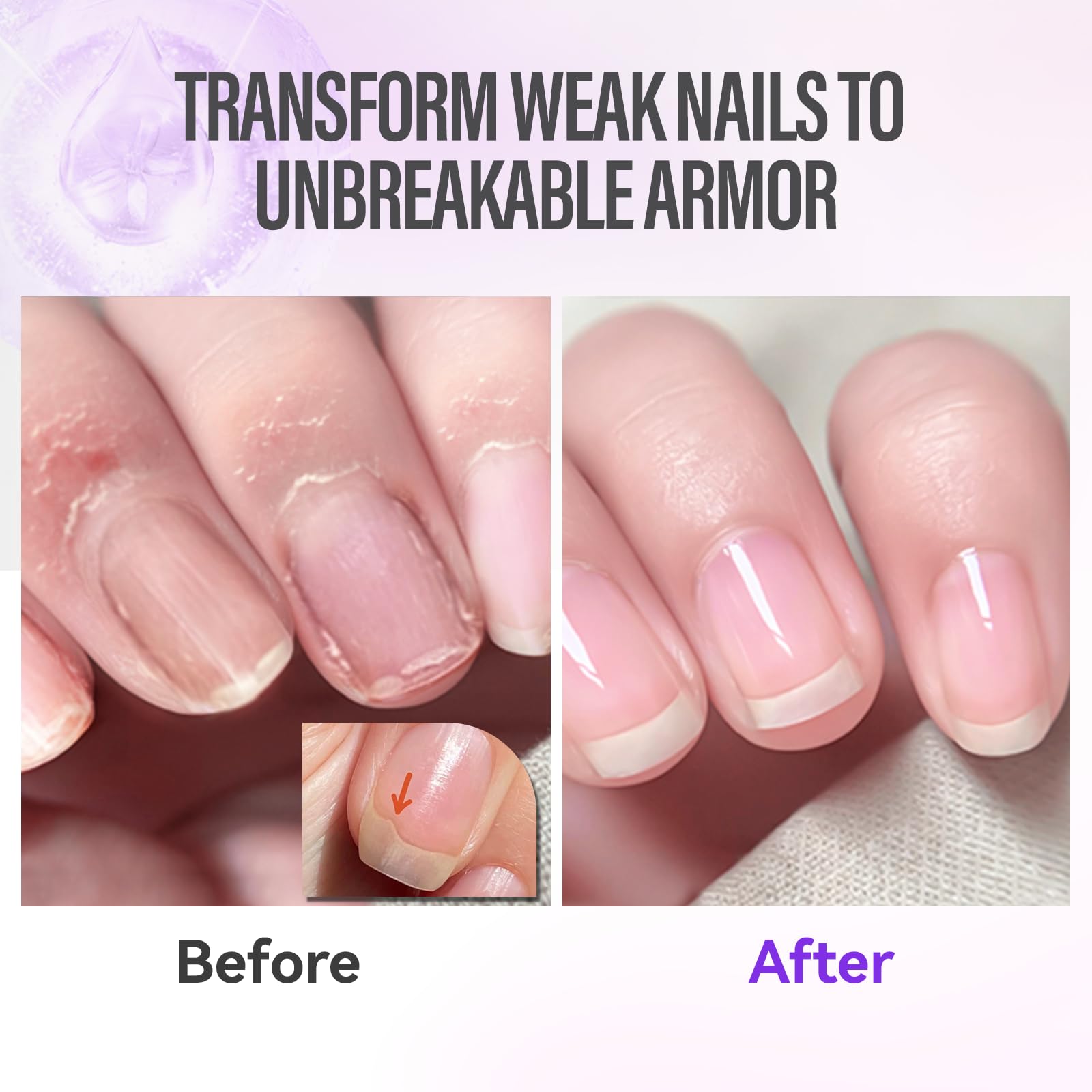 CHUCHU Nail Growth and Strengthener Oil for Cuticle - Repair Moisturizing Treatment - Natural Jojoba Vitamin B & E Nail Oil for Dry Cracked Nails (Lavender 01)