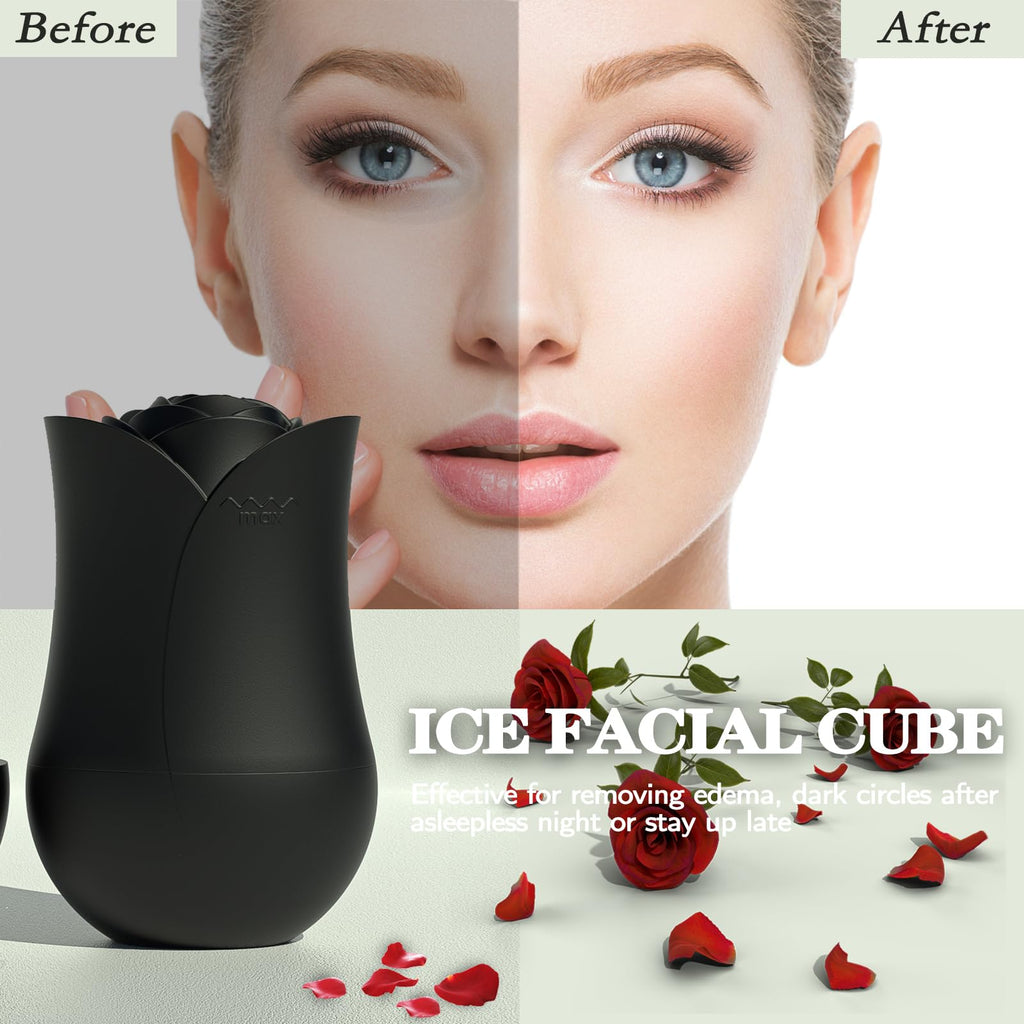Xkmiess Ice Roller For Face，Cryo Cube Ice Roller For Facial And Eye,Skincare Tools,For Relieving Facial Edema, Shrinking Pores, And Lifting And Firming The Skin (Black)